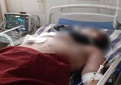 प्रेमिका पर तेजाब फेंक जिंदा जलाने की कोशिश की